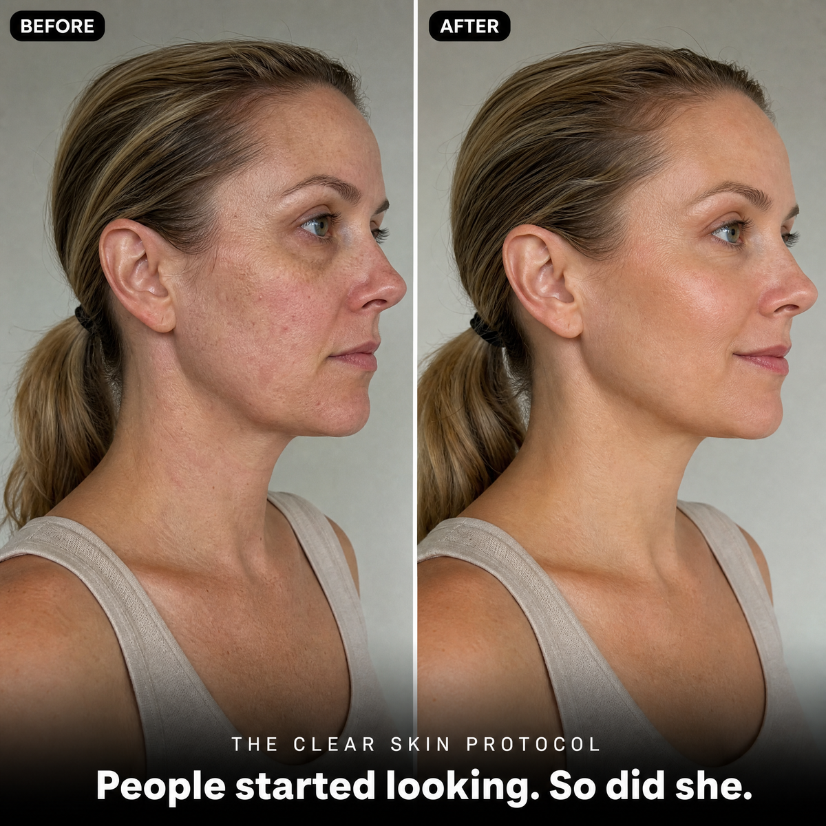 The Clear Skin Protocol