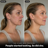 The Clear Skin Protocol