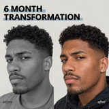 JAWESTHETIC® 3.0 - Jawline Trainer
