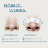 Aesthetic Lab® Nose Tape