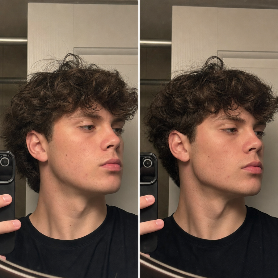 Softer jaw to a visible angle