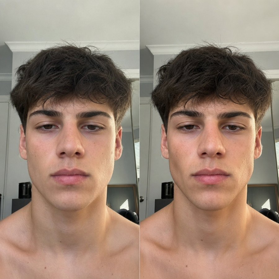 Softer jaw to a visible angle