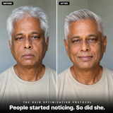 The Hair Optimization Protocol