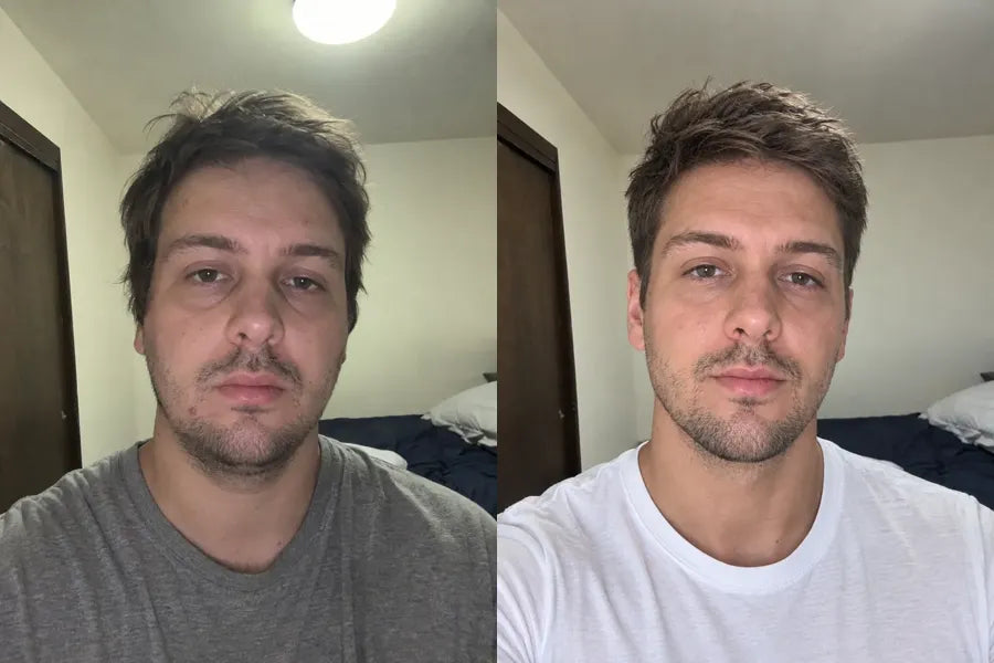 The jaw shows up